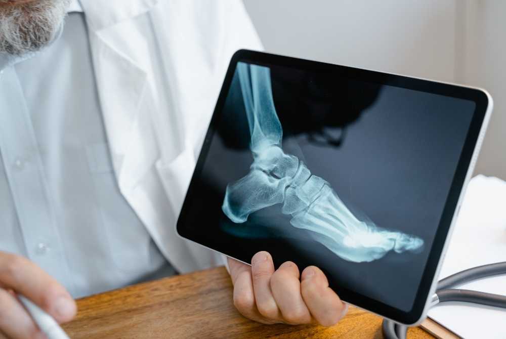 doctor reviewing x ray for bone fracture diagnosis